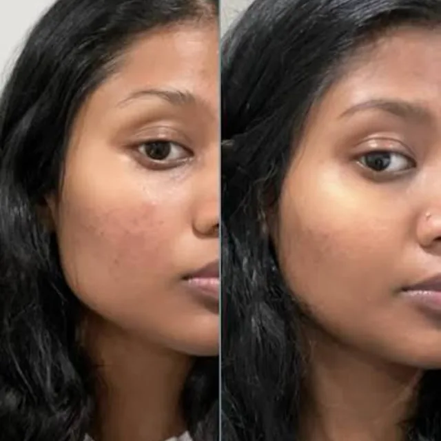 Antes e depois 2