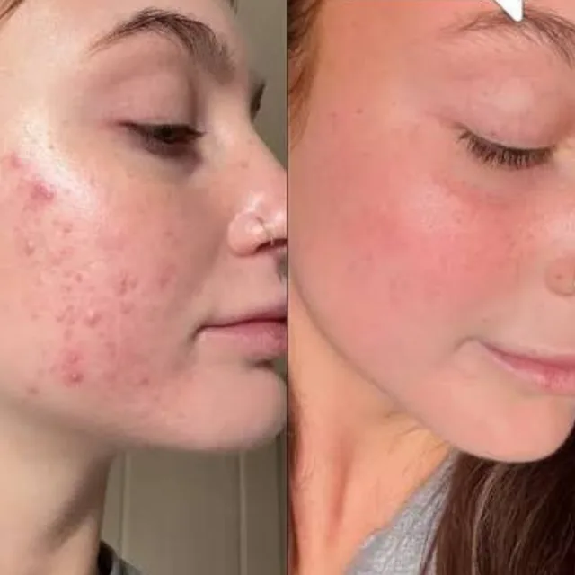 Antes e depois 3