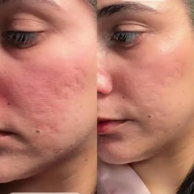 Antes e depois 4