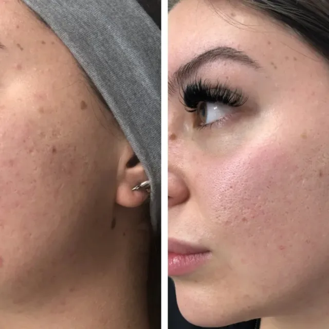 Antes e depois 5