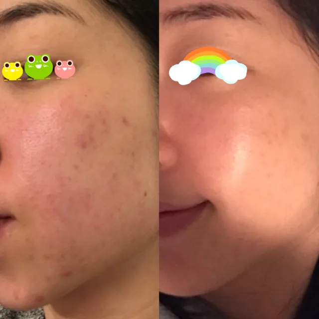 Antes e depois 6